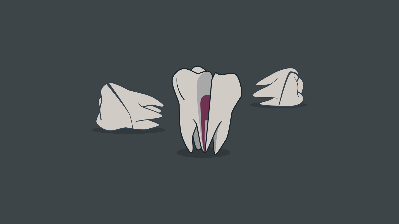 Ce que trois dents perdues m'ont appris sur le management